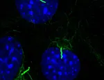 Primary cilia 
