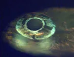 Zebrafish (Danio rerio)