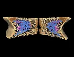 The Bionic Bone