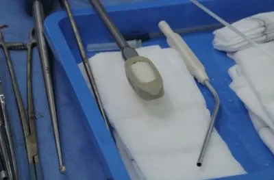 Inductigraft™ packed into a vertebral spacer