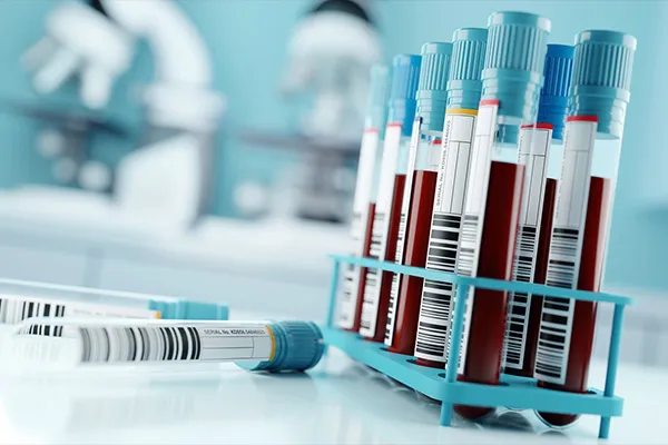 Blood samples in a laboratory