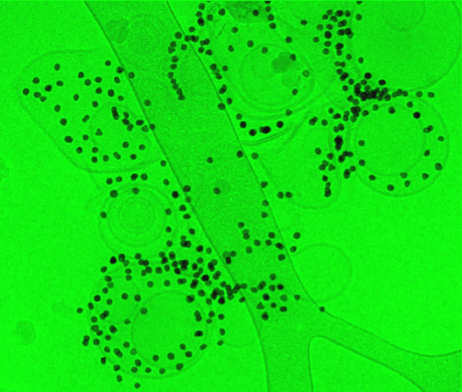 Annexin 5 positive microvessicles