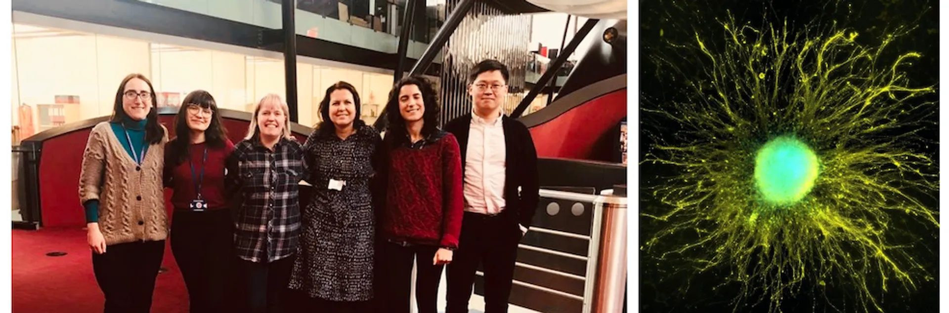 Photo of members of the Bochukova lab next to a microscopy image of a cell