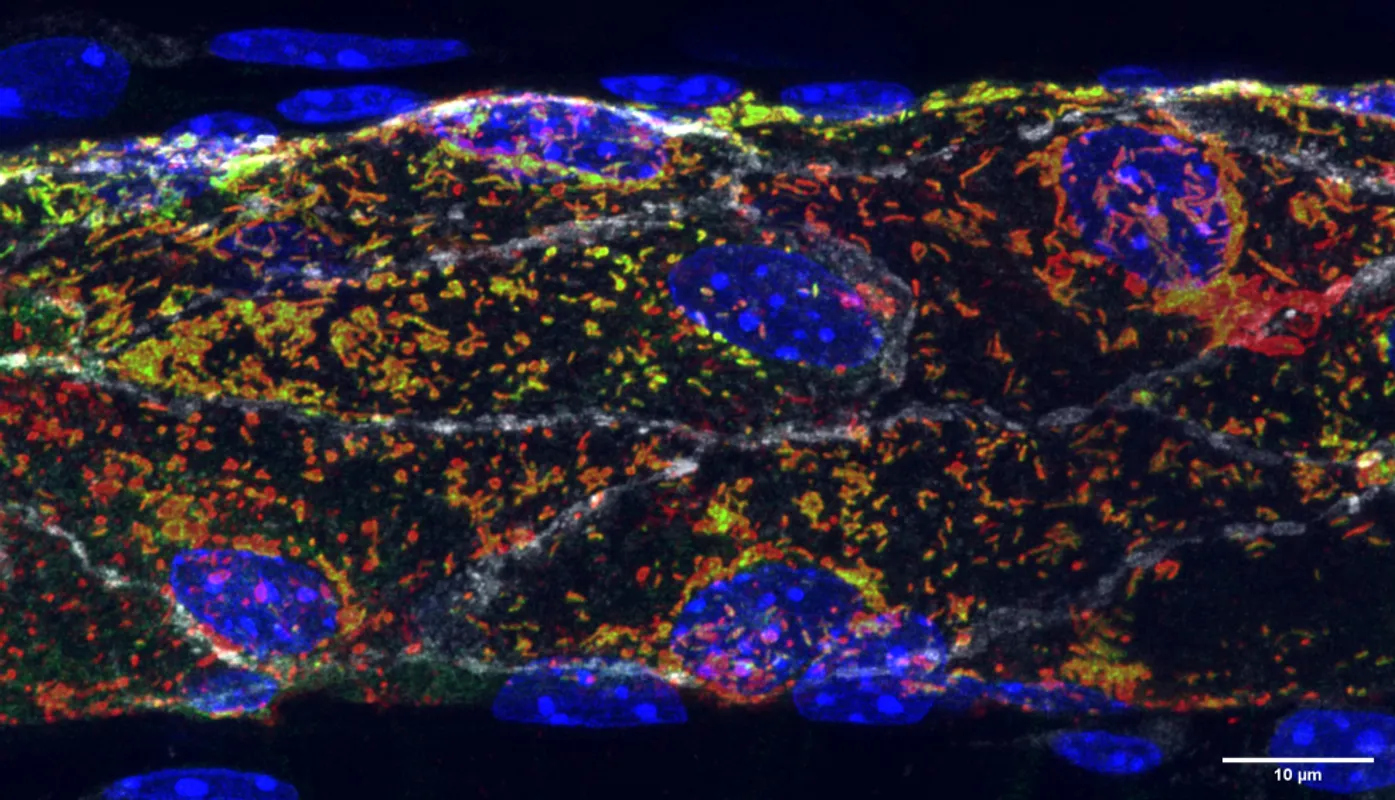Storage of a blood clotting factor in the mouse microvascular venule.