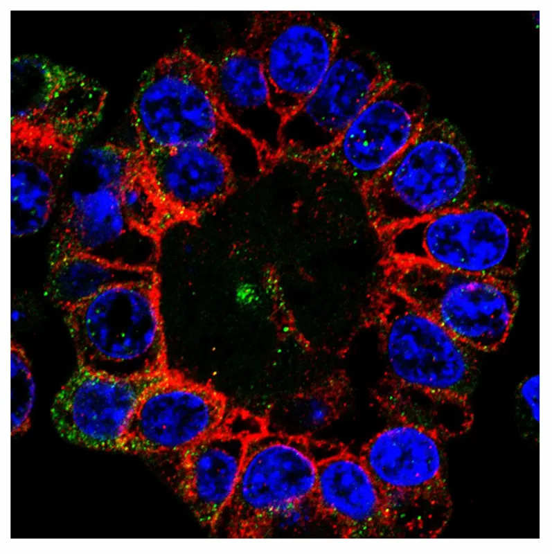 Image of: Combining MET inhibition with chemotherapy in ovarian cancer to improve patient outcome 