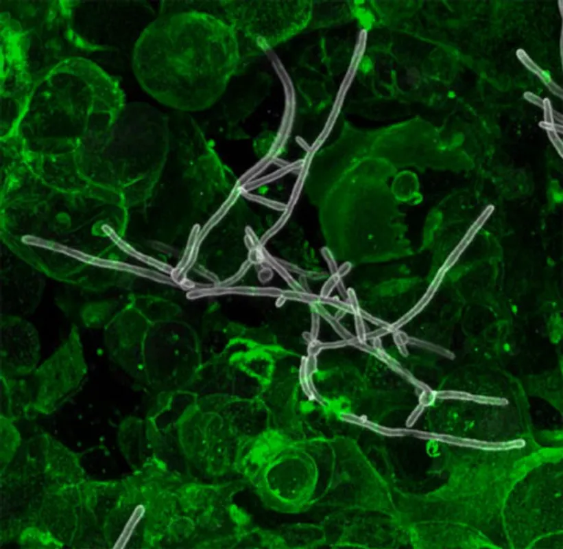 Image of: Exploring how host-fungal dynamics in the human gut drive severe forms of inflammatory bowel disease (IBD) in South Asian patients