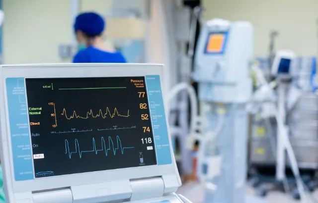 EKG monitor