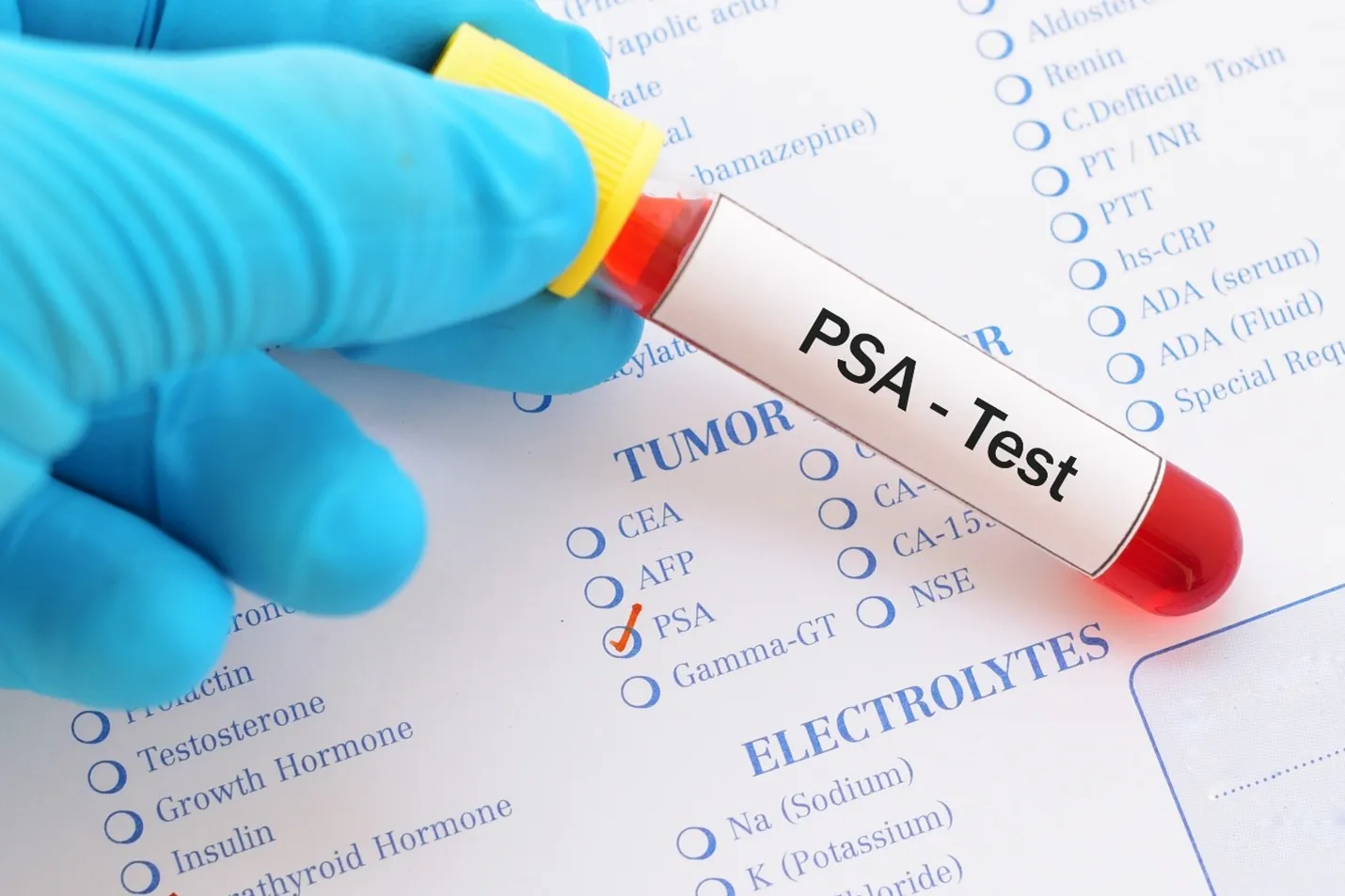PSA test