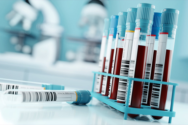 Blood samples in a laboratory